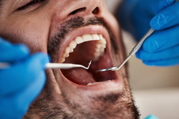 Best Oral Cancer Screening  in Chanute, KS